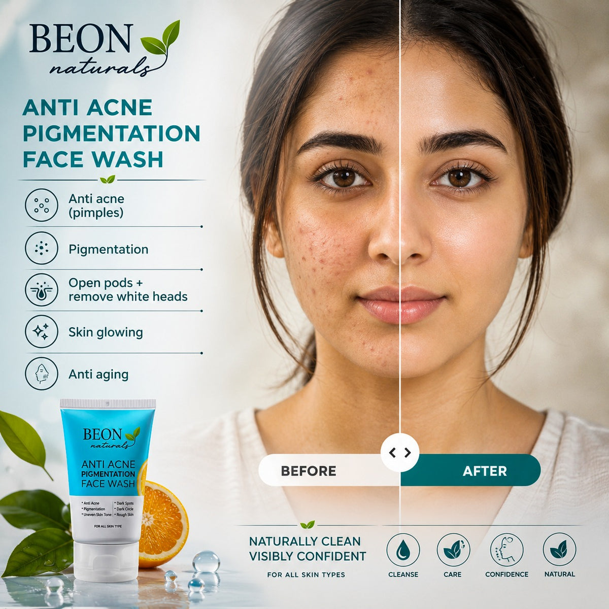 Beon Anti Acne Pigmentation Face Kit