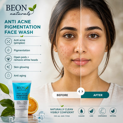 Beon Anti Acne Pigmentation Face Kit